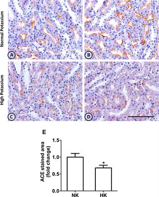 Dietary Potassium Downregulates Angiotensin-I Converting Enzyme, Renin, and Angiotensin Converting Enzyme 2